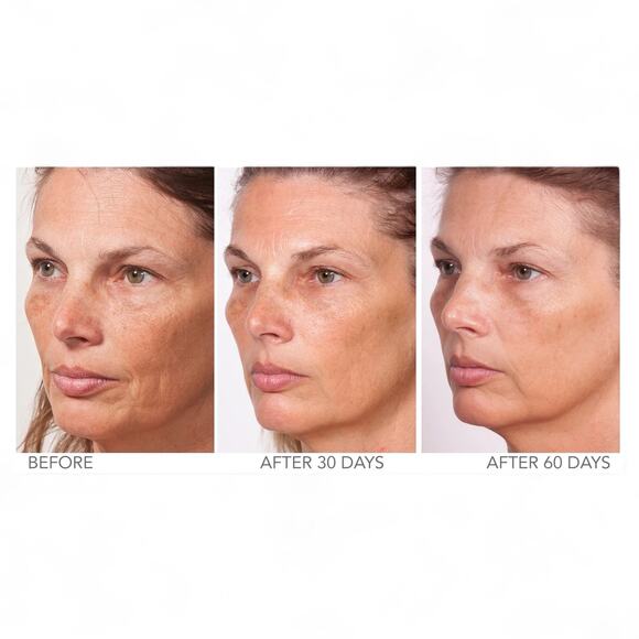 Serious Skincare Pure Pep Concentrate 30% Pure Peptide & Neuropeptide 1 fl oz - Picture 4 of 11